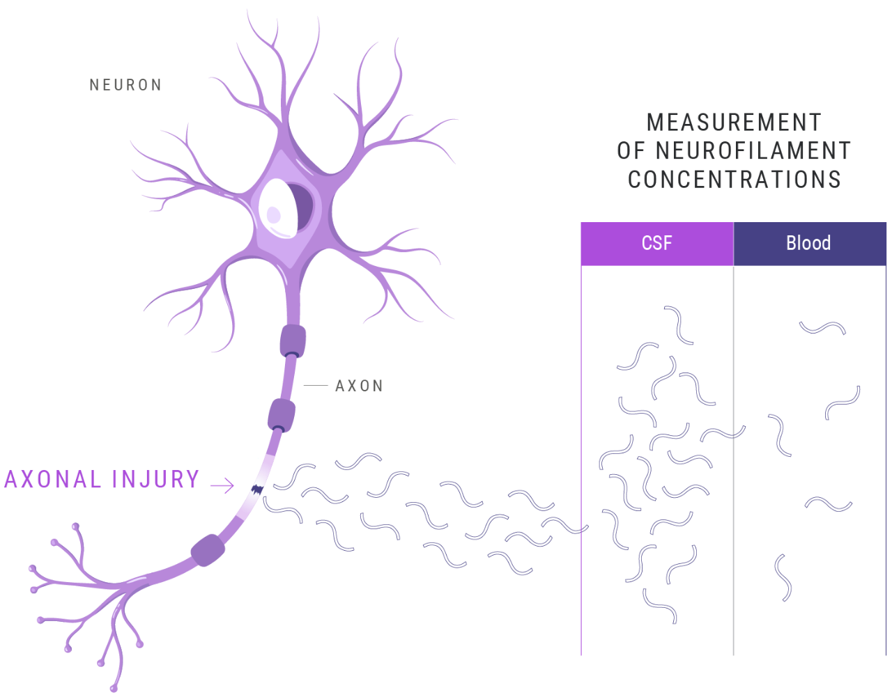 Neuron with axon injury diagram