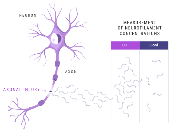 Neuron with axon injury diagram